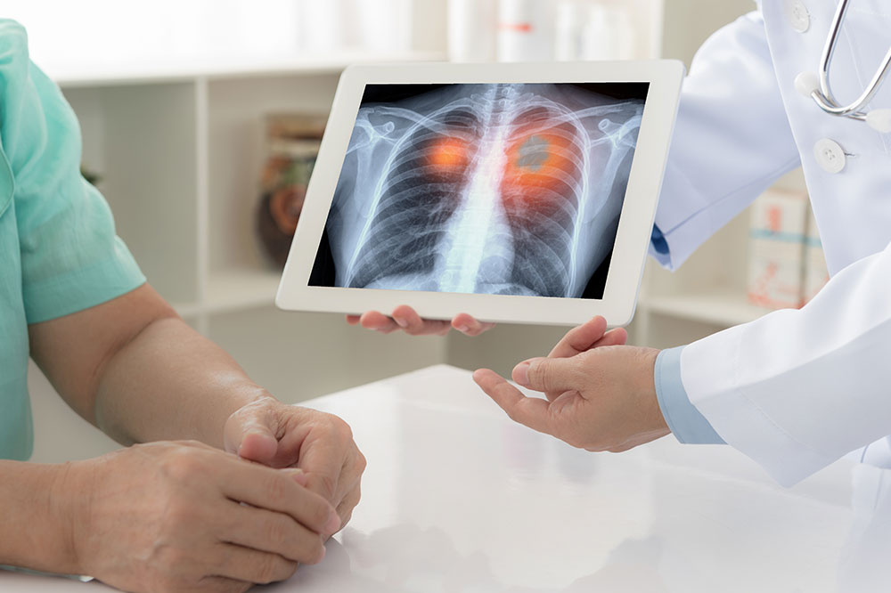 Measures That Reduce the Risk of Cancer