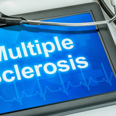 Multiple Sclerosis – Common Causes and Symptoms