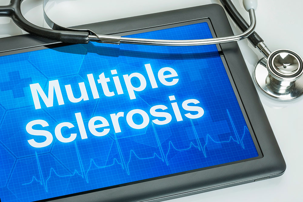 Multiple Sclerosis – Common Causes and Symptoms