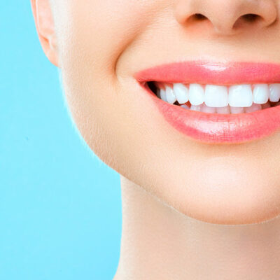 Top 5 Myths About Natural Ways to Whiten Teeth