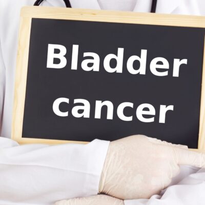 5 Early Warning Signs of Bladder Cancer