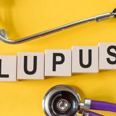 5 Major Warning Signs of Lupus